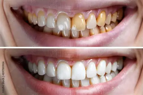 Professional Teeth Cleaning